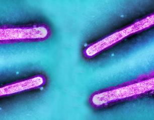Influenza A (H5N1) virus particles (rod shaped)