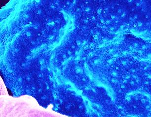 Malaria infected blood cell