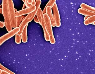 Purple background with orange cylinders (TB particles) scattered and gathered around