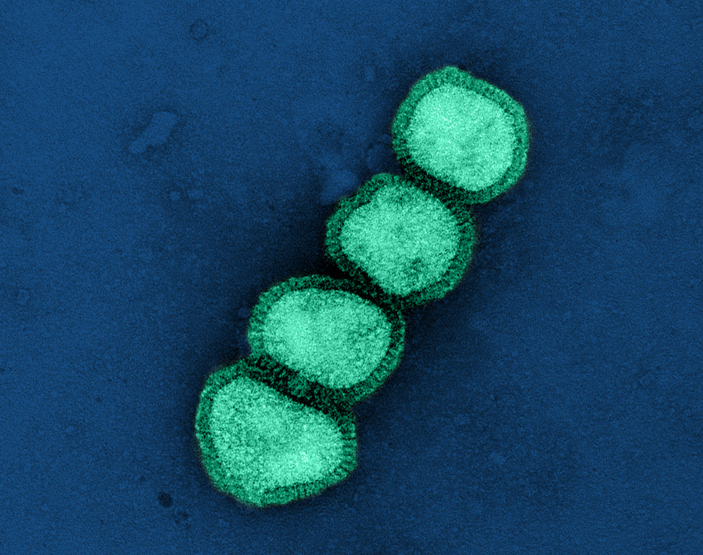Microscopic view of the influenza A virus, a key focus in infectious disease research and vaccine development.